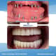 Slider image (9) Dent Antalya